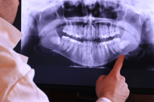 Best Emergency Dental Extractions in Park Center, CO