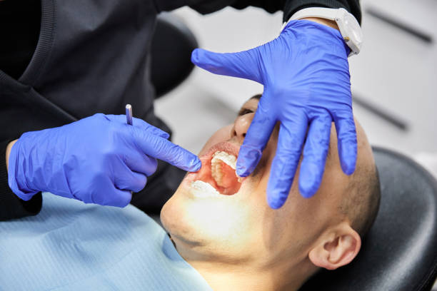 Best Emergency Dental Care for Abscessed Tooth in Park Center, CO